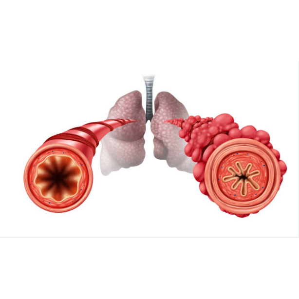 Diacetyl Popcorn Lung EDGE Vaping