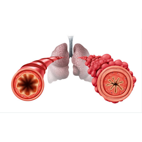 Diacetyl Popcorn Lung EDGE Vaping